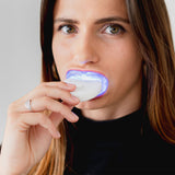 Kit de blanchiment dentaire goût citron - Soin blancheur à domicile - Secrets de Simone